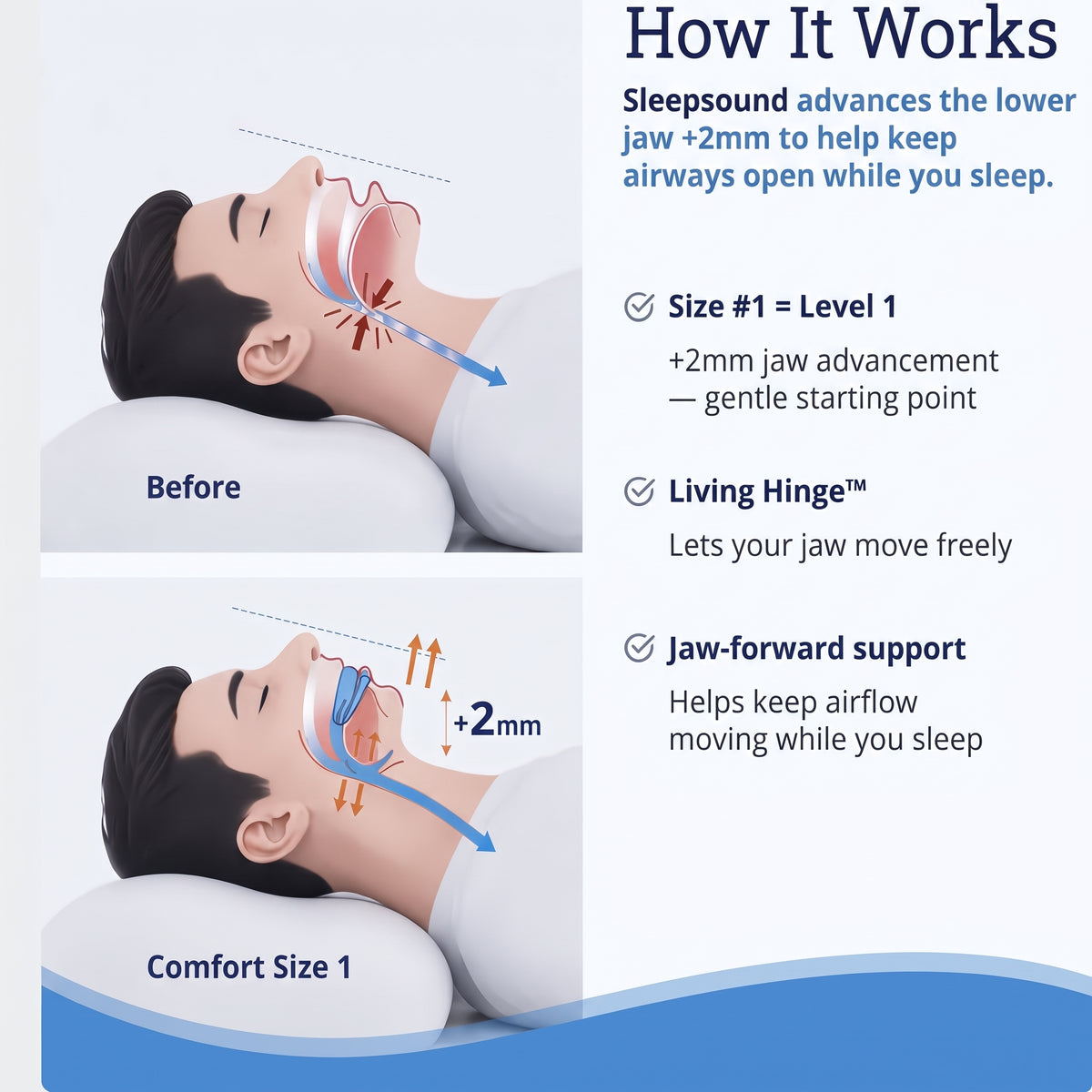 Sleepsound Anti-Snoring Mouthpiece