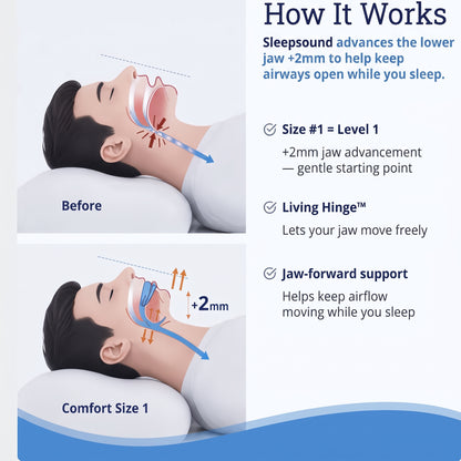 Sleepsound Anti-Snoring Mouthpiece